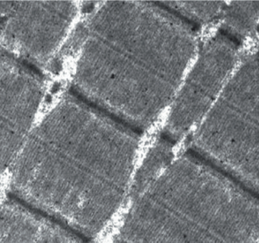 Мышечная ткань, 100 нм.png