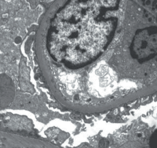 Тонкий срез почки, 500 нм.png