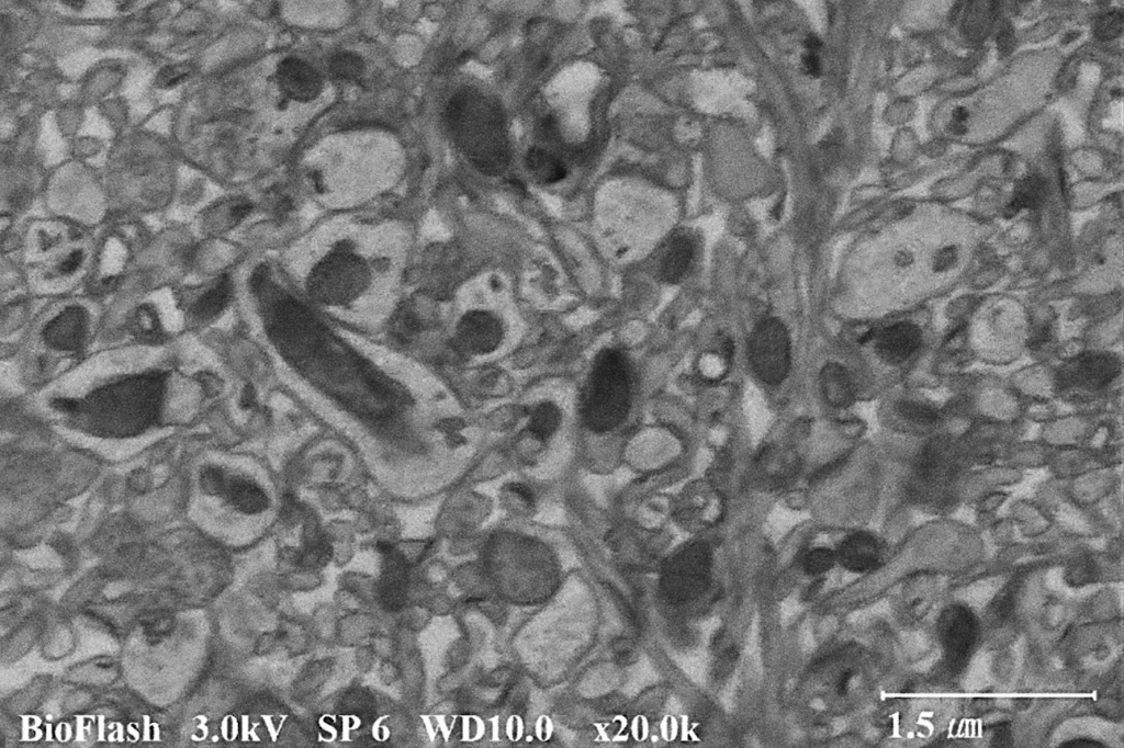 liver tissue cells.jpg
