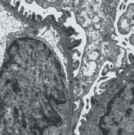 Тонкий срез почки, 1 мкм.png