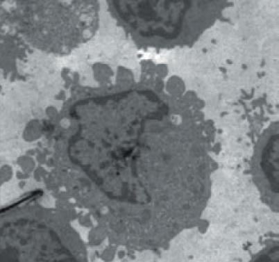 Лимфоциты 2 мкм.png