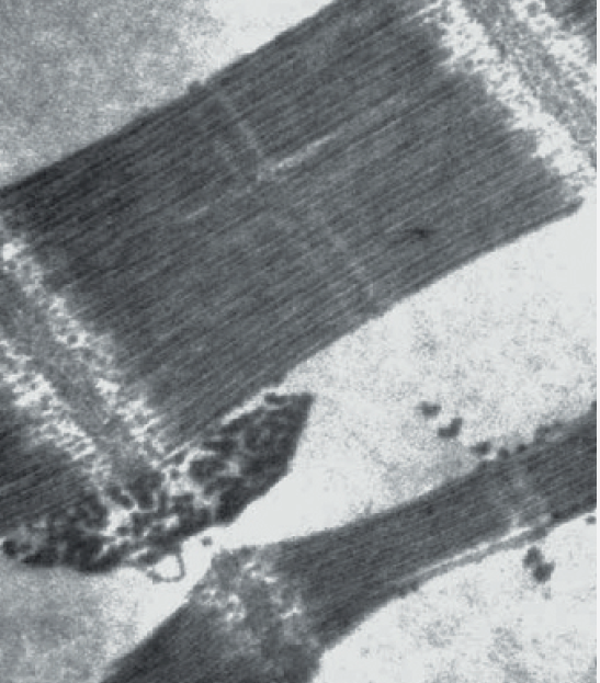 Тонкий срез мышечной ткани, 0.5 мкм.png