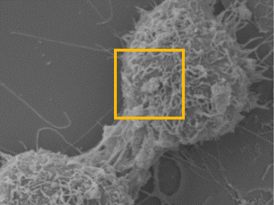 SEM 10,000 times.jpg