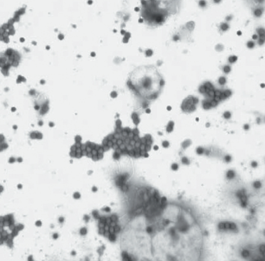 Аденовирус, 200 нм.png