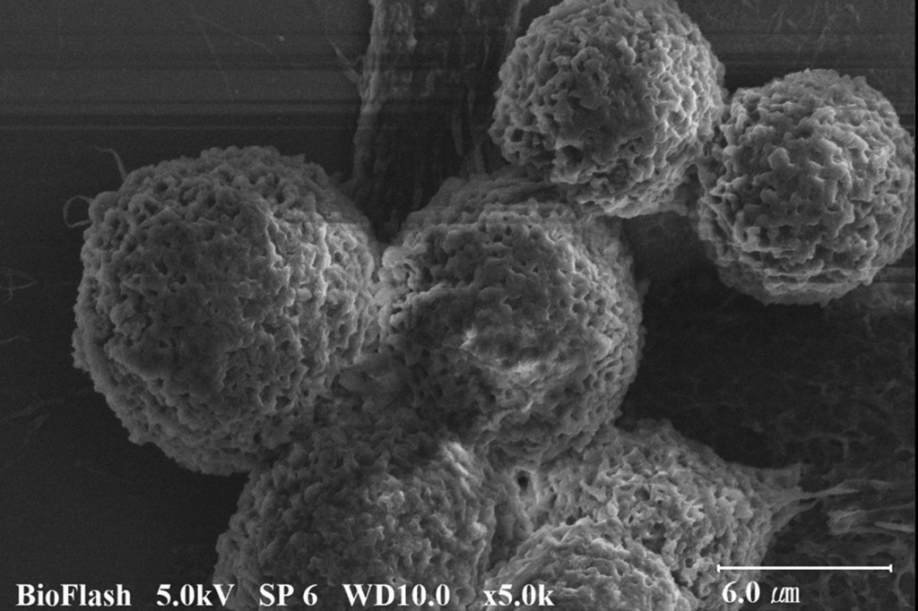 HeLa cell SEM 5.0K.jpg