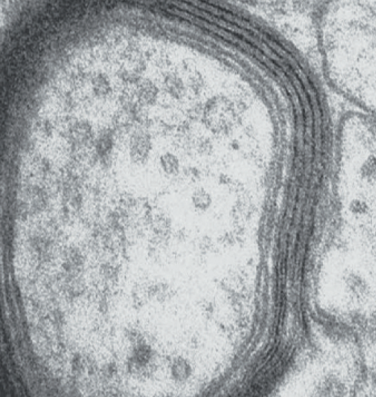 Тонкий срез нерва, 50 нм.png