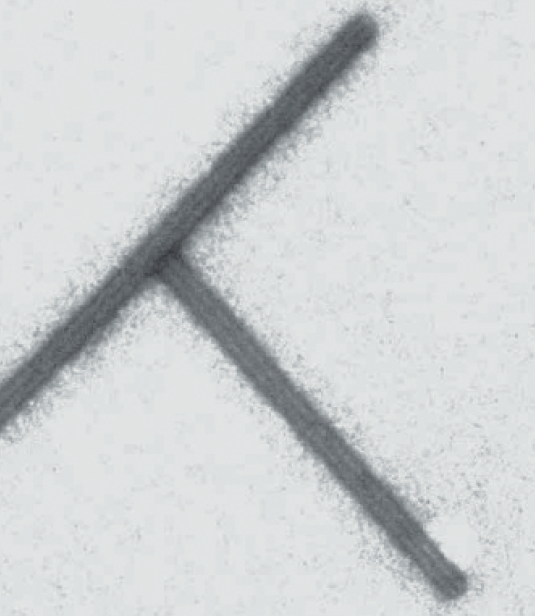 Вирус табачной мозаики, 100 нм.png